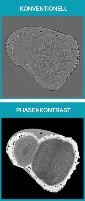 Roentgen Phasenkontrast Mikro CT von einem Samen